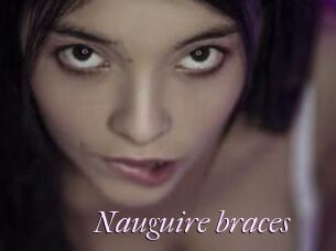 Nauguire_braces